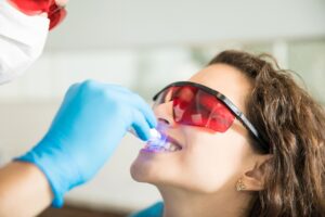 Aclaramiento Dental - Metrodent - Consultorio de Especialidades Odontológicas