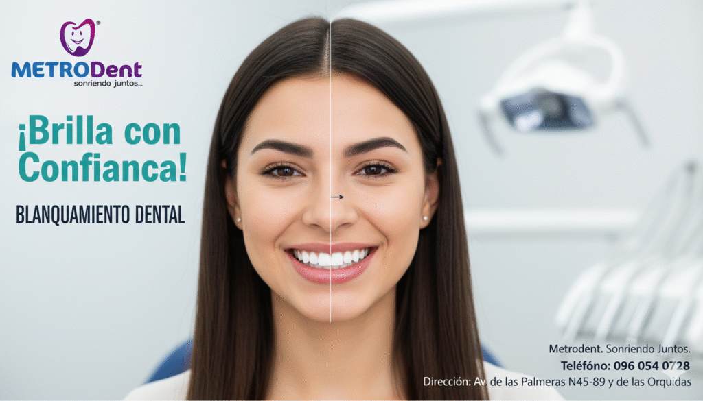 Blanqueamiento Dental en Metrodent: La forma segura y rápida de encender tu sonrisa. ¡Brilla con confianza!
