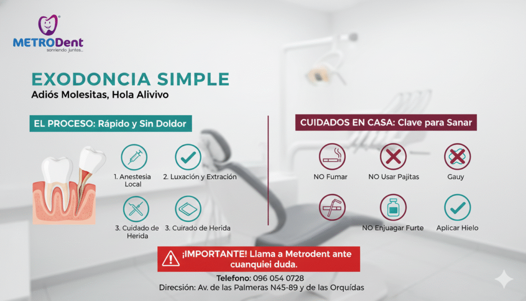 exodoncias simples, extracción dental simple, sacar muela, procedimiento extracción, cuidados post extracción, muela irreparable, dientes insalvables, ligamento periodontal, Metrodent, odontología