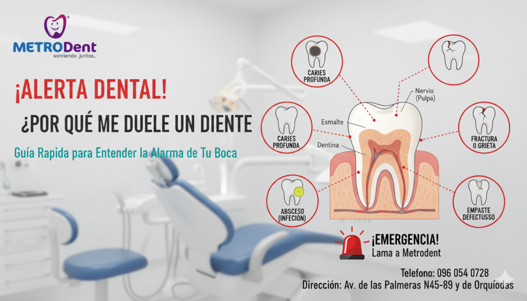 por que me duele un diente, dolor de muela, diente dolorido, caries profunda, fractura dental, absceso dental, empaste defectuoso, dolor al masticar, pulpitis, Metrodent, emergencia dental